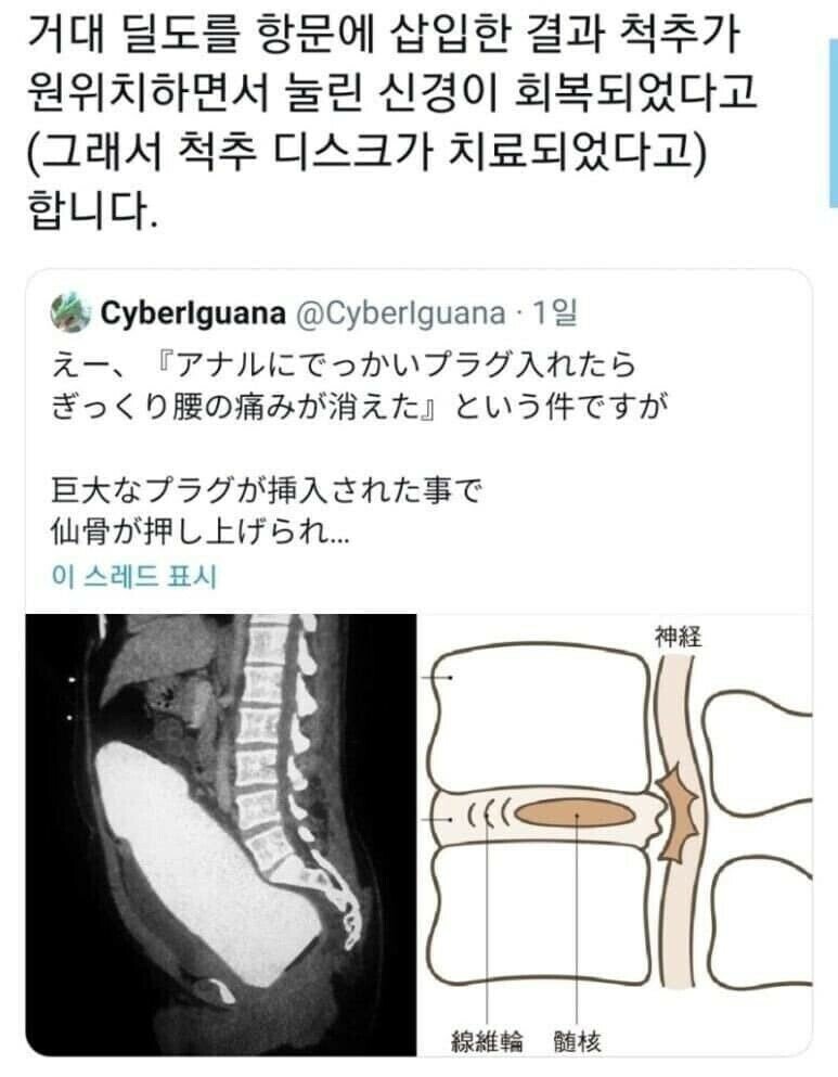 거대한 것 효능